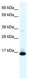 POD1 antibody, TA334024, Origene, Western Blot image 