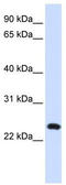 Lysosomal Associated Membrane Protein Family Member 5 antibody, TA341902, Origene, Western Blot image 