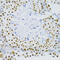 Small Nuclear Ribonucleoprotein U1 Subunit 70 antibody, 19-993, ProSci, Immunohistochemistry frozen image 