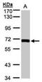 Coenzyme A Synthase antibody, GTX107934, GeneTex, Western Blot image 