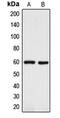 Dopachrome Tautomerase antibody, LS-C352108, Lifespan Biosciences, Western Blot image 