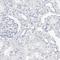 Secretory Leukocyte Peptidase Inhibitor antibody, NBP1-89139, Novus Biologicals, Immunohistochemistry paraffin image 