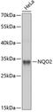 N-Ribosyldihydronicotinamide:Quinone Reductase 2 antibody, 19-663, ProSci, Western Blot image 