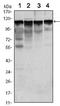 Hexokinase-1 antibody, AM06498SU-N, Origene, Western Blot image 