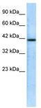 CHRNA7 (Exons 5-10) And FAM7A (Exons A-E) Fusion antibody, TA338732, Origene, Western Blot image 