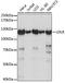Low Density Lipoprotein Receptor antibody, A14996, ABclonal Technology, Western Blot image 