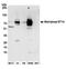 Suppression Of Tumorigenicity 14 antibody, NB100-2308, Novus Biologicals, Western Blot image 