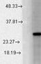 Potassium Calcium-Activated Channel Subfamily M Regulatory Beta Subunit 2 antibody, LS-C230894, Lifespan Biosciences, Western Blot image 