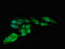 Ribosomal Protein S4 Y-Linked 1 antibody, LS-C679354, Lifespan Biosciences, Immunofluorescence image 
