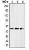 PBX/Knotted 1 Homeobox 2 antibody, GTX55970, GeneTex, Western Blot image 
