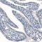 Phosphoglucomutase-1 antibody, AMAb91155, Atlas Antibodies, Immunohistochemistry frozen image 