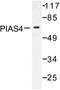 Protein Inhibitor Of Activated STAT 4 antibody, LS-C176344, Lifespan Biosciences, Western Blot image 