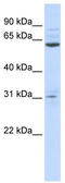 Intestine Specific Homeobox antibody, TA342399, Origene, Western Blot image 