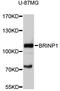 Deleted in bladder cancer protein 1 antibody, abx125578, Abbexa, Western Blot image 