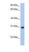 Carbohydrate Sulfotransferase 14 antibody, NBP1-55174, Novus Biologicals, Western Blot image 