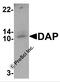 Death Associated Protein antibody, 7389, ProSci, Western Blot image 