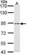Progesterone Receptor antibody, TA308936, Origene, Western Blot image 