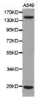 Integrin Subunit Alpha V antibody, LS-C193059, Lifespan Biosciences, Western Blot image 