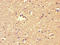 F-Box And Leucine Rich Repeat Protein 18 antibody, LS-C317899, Lifespan Biosciences, Immunohistochemistry paraffin image 