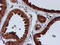 Chromosome 1 Open Reading Frame 50 antibody, TA502937, Origene, Immunohistochemistry paraffin image 