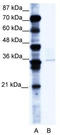 BMI1 Proto-Oncogene, Polycomb Ring Finger antibody, TA335718, Origene, Western Blot image 