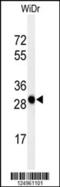 Progestin And AdipoQ Receptor Family Member 3 antibody, 61-636, ProSci, Western Blot image 