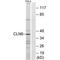 CLN6 Transmembrane ER Protein antibody, PA5-50006, Invitrogen Antibodies, Western Blot image 