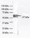 Keratin 10 antibody, 39-5300, Invitrogen Antibodies, Western Blot image 