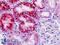 Stromal Interaction Molecule 2 antibody, LS-B9326, Lifespan Biosciences, Immunohistochemistry paraffin image 