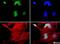 Ubiquitin Conjugating Enzyme E2 E1 antibody, NBP1-78983, Novus Biologicals, Immunocytochemistry image 
