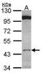 Clusterin-associated protein 1 antibody, GTX106897, GeneTex, Western Blot image 
