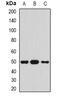 Serpin Family A Member 4 antibody, abx142217, Abbexa, Western Blot image 