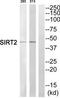 SIR2 antibody, TA312353, Origene, Western Blot image 