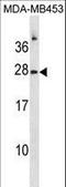 RNase 1 antibody, LS-B15672, Lifespan Biosciences, Western Blot image 