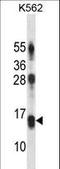 Lymphocyte Antigen 86 antibody, LS-C163934, Lifespan Biosciences, Western Blot image 