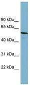 Phosphoacetylglucosamine mutase antibody, TA345110, Origene, Western Blot image 