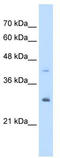 Calcyclin Binding Protein antibody, TA339163, Origene, Western Blot image 