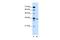 Solute Carrier Family 25 Member 32 antibody, PA5-42496, Invitrogen Antibodies, Western Blot image 