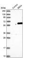 Bardet-Biedl Syndrome 4 antibody, PA5-58783, Invitrogen Antibodies, Western Blot image 