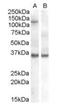 Argonaute RISC Component 1 antibody, orb19184, Biorbyt, Western Blot image 