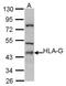 Major Histocompatibility Complex, Class I, G antibody, GTX101149, GeneTex, Western Blot image 