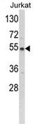 Branched Chain Keto Acid Dehydrogenase E1 Subunit Alpha antibody, AP17149PU-N, Origene, Western Blot image 