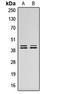 Erk1 antibody, LS-C368413, Lifespan Biosciences, Western Blot image 