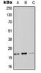 Claudin 9 antibody, orb214857, Biorbyt, Western Blot image 
