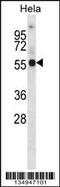 Potassium voltage-gated channel subfamily A member 1 antibody, 57-956, ProSci, Western Blot image 