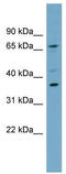Mitochondrial E3 Ubiquitin Protein Ligase 1 antibody, TA330465, Origene, Western Blot image 