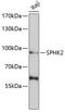 Sphingosine Kinase 2 antibody, 22-458, ProSci, Western Blot image 
