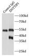 Deoxynucleotidyltransferase terminal-interacting protein 1 antibody, FNab02490, FineTest, Immunoprecipitation image 