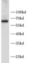 Eukaryotic Translation Initiation Factor 2 Alpha Kinase 1 antibody, FNab10450, FineTest, Western Blot image 