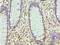 LIM Zinc Finger Domain Containing 1 antibody, orb39655, Biorbyt, Immunohistochemistry paraffin image 